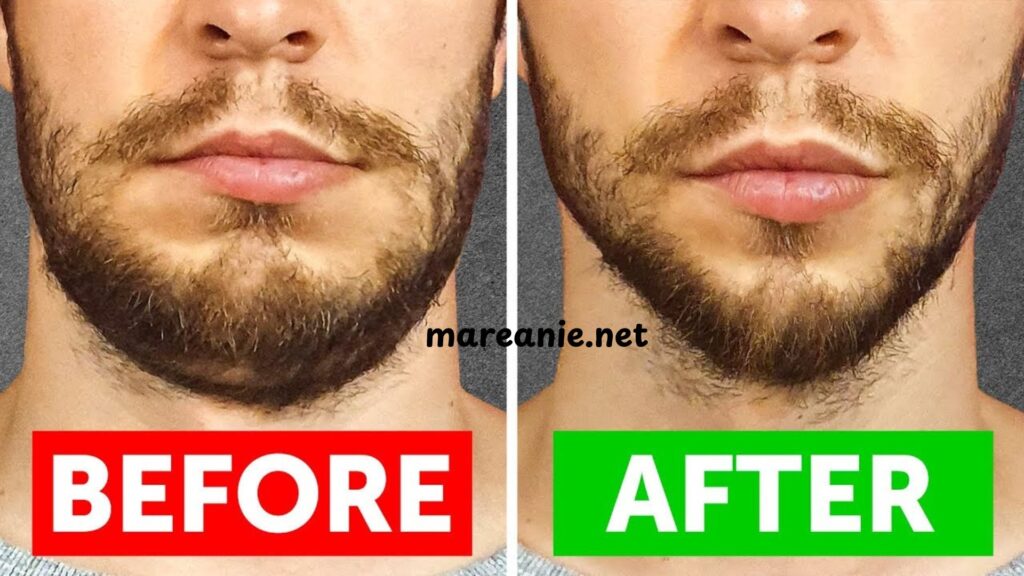 How to Reduce Face Fat
