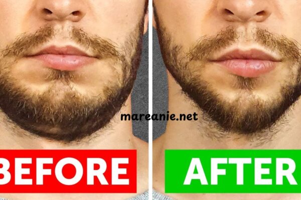 How to Reduce Face Fat